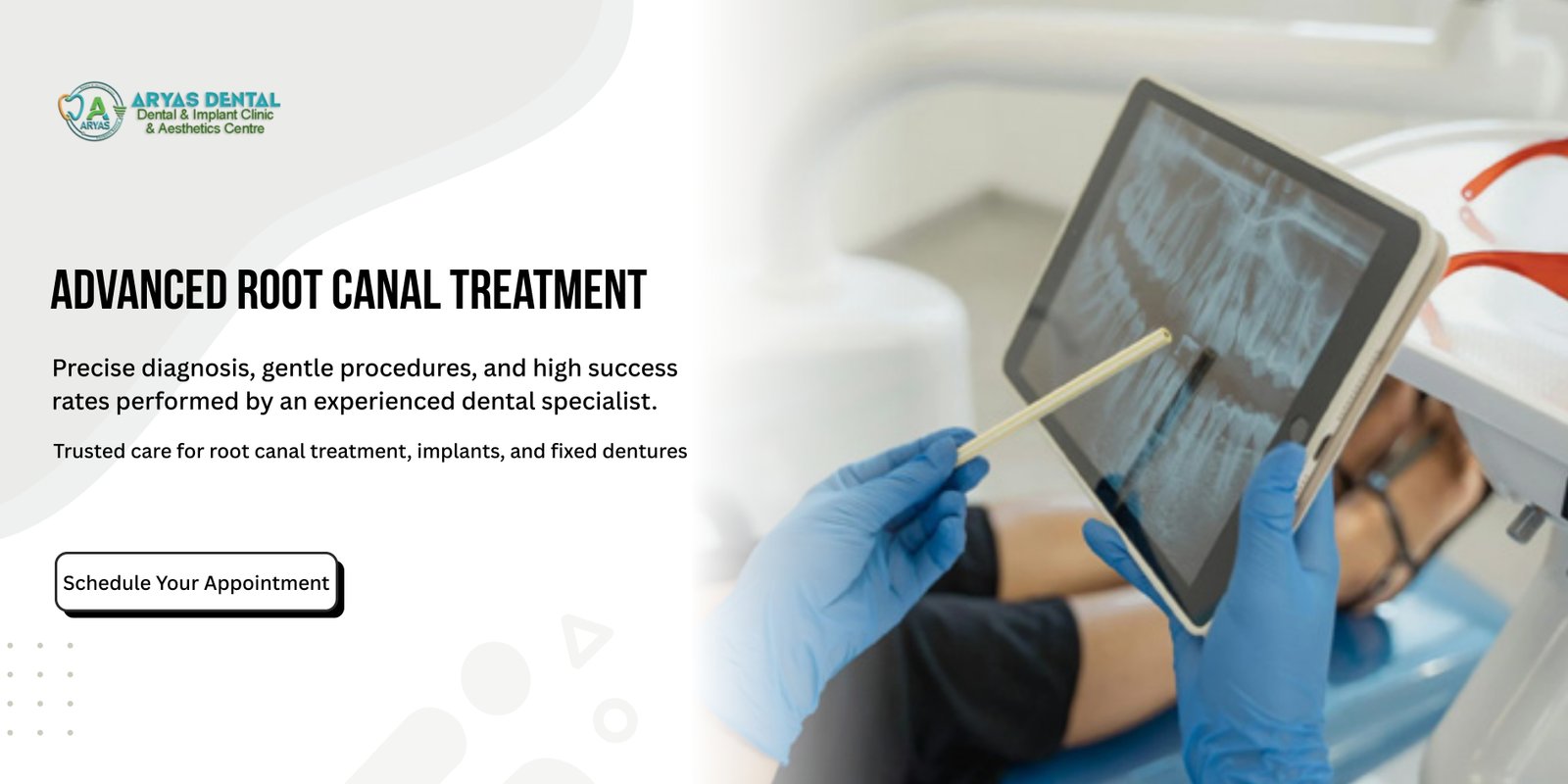 root-canal-treatment-by-best-dentist-in-ghaziabad-at-Aryas-dental-clinic